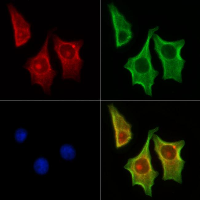 MAP1S Antibody in Immunocytochemistry (ICC/IF)