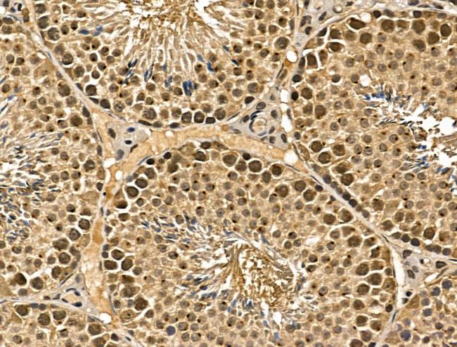 MGAT4C Antibody in Immunohistochemistry (Paraffin) (IHC (P))