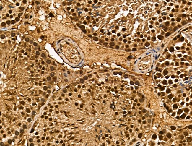 MSRA Antibody in Immunohistochemistry (Paraffin) (IHC (P))