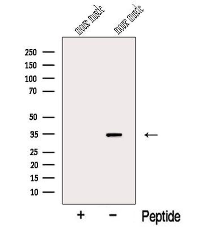 MYOZ1 Antibody in Western Blot (WB)