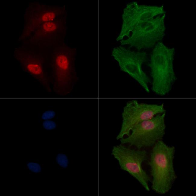 NR1 Antibody in Immunocytochemistry (ICC/IF)