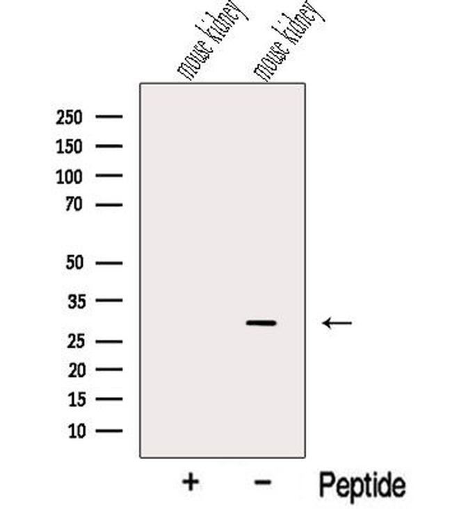 NIT2 Antibody in Western Blot (WB)