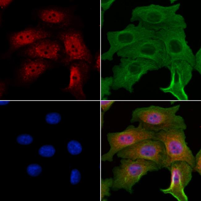 NME5 Antibody in Immunocytochemistry (ICC/IF)