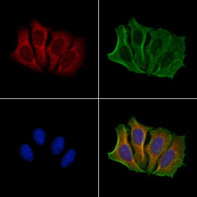 NOXA Antibody in Immunocytochemistry (ICC/IF)