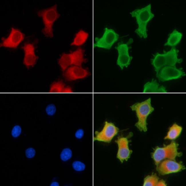 NPLOC4 Antibody in Immunocytochemistry (ICC/IF)