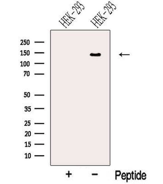 NRCAM Antibody in Western Blot (WB)