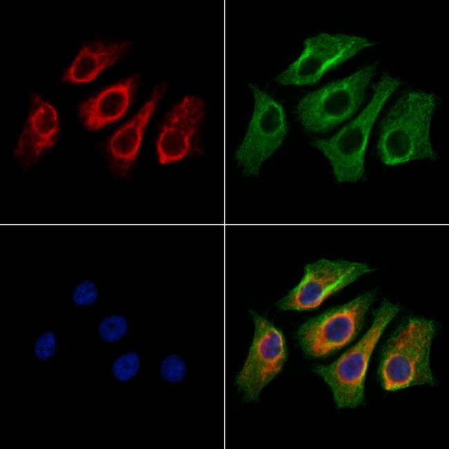 NUDT9 Antibody in Immunocytochemistry (ICC/IF)