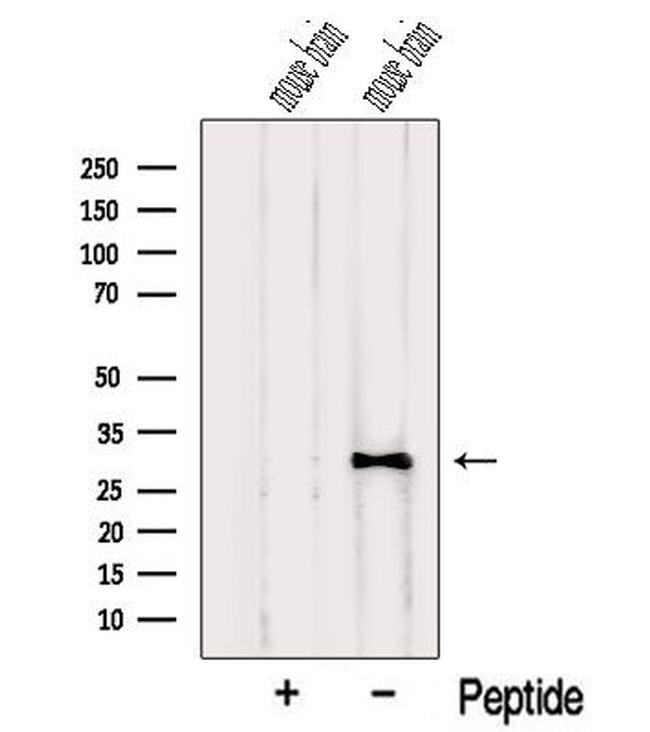 NUS1 Antibody in Western Blot (WB)