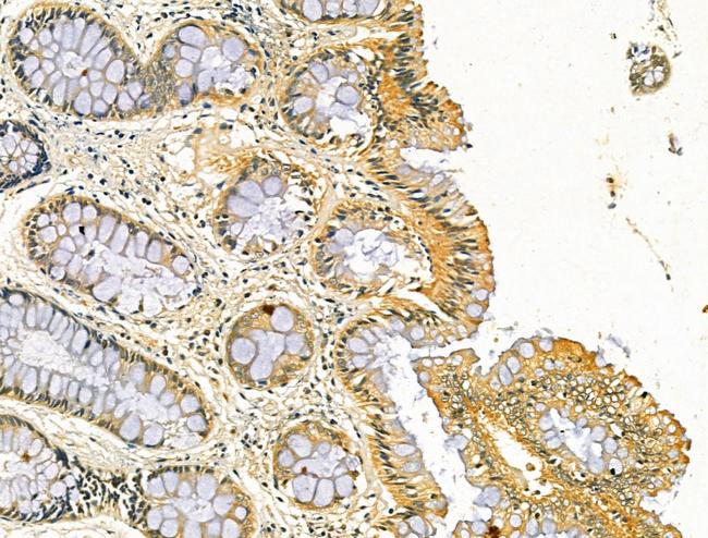 ODF2L Antibody in Immunohistochemistry (Paraffin) (IHC (P))