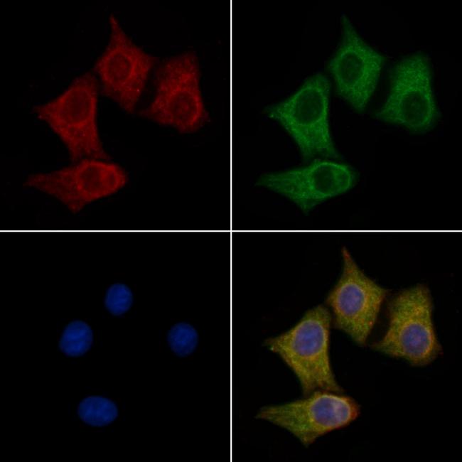 UCP4 Antibody in Immunocytochemistry (ICC/IF)