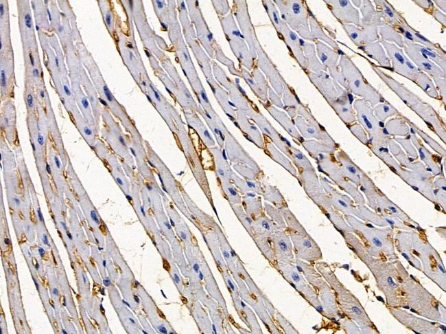 GPSN2 Antibody in Immunohistochemistry (Paraffin) (IHC (P))