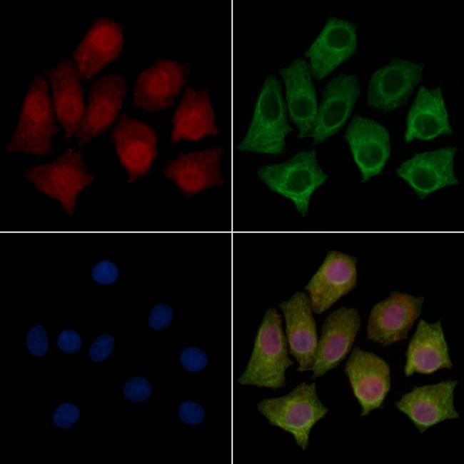 eIF2b beta Antibody in Immunocytochemistry (ICC/IF)