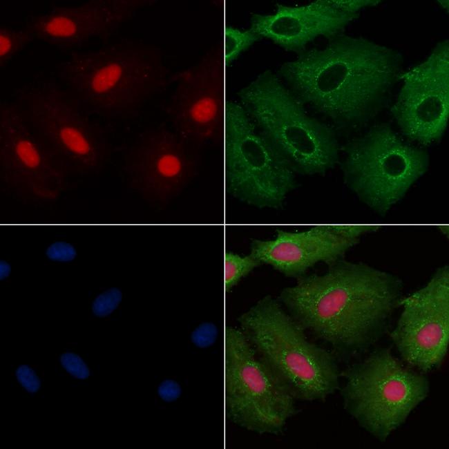 APR3 Antibody in Immunocytochemistry (ICC/IF)