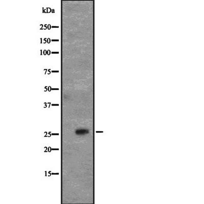 CD63 Antibody in Western Blot (WB)