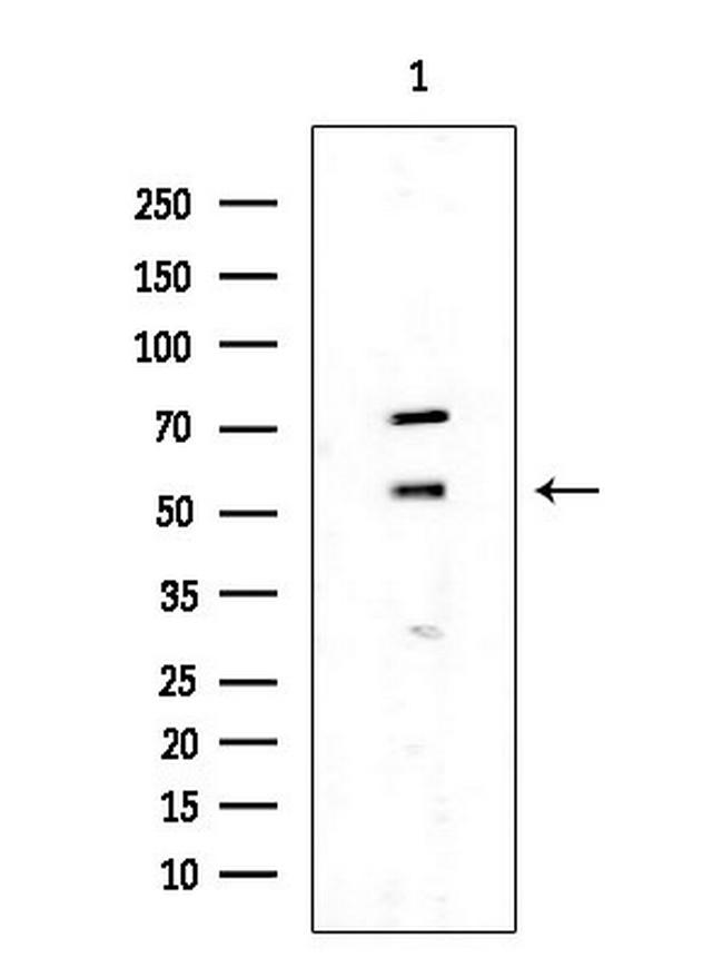 CDK8 Antibody in Western Blot (WB)