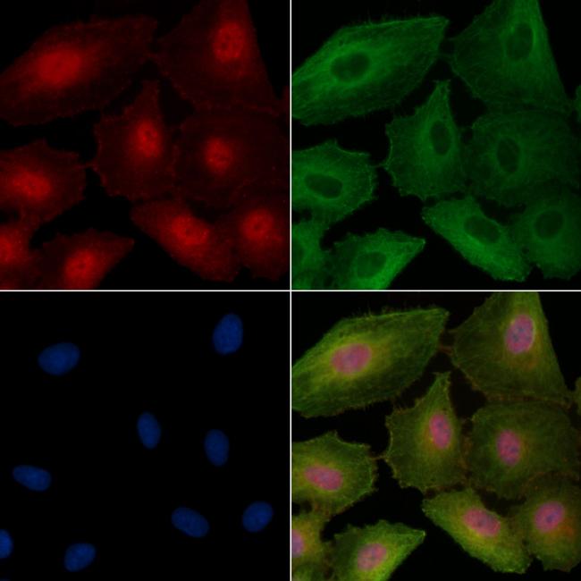 CENPT Antibody in Immunocytochemistry (ICC/IF)