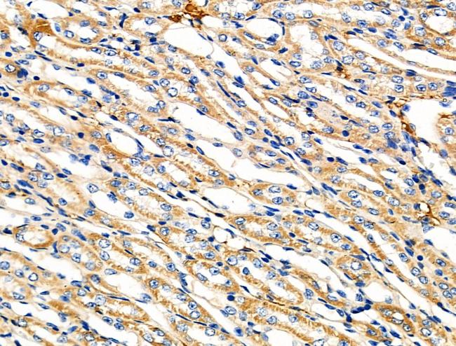 ZPK Antibody in Immunohistochemistry (Paraffin) (IHC (P))