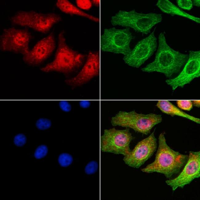 TFAP2D Antibody in Immunocytochemistry (ICC/IF)