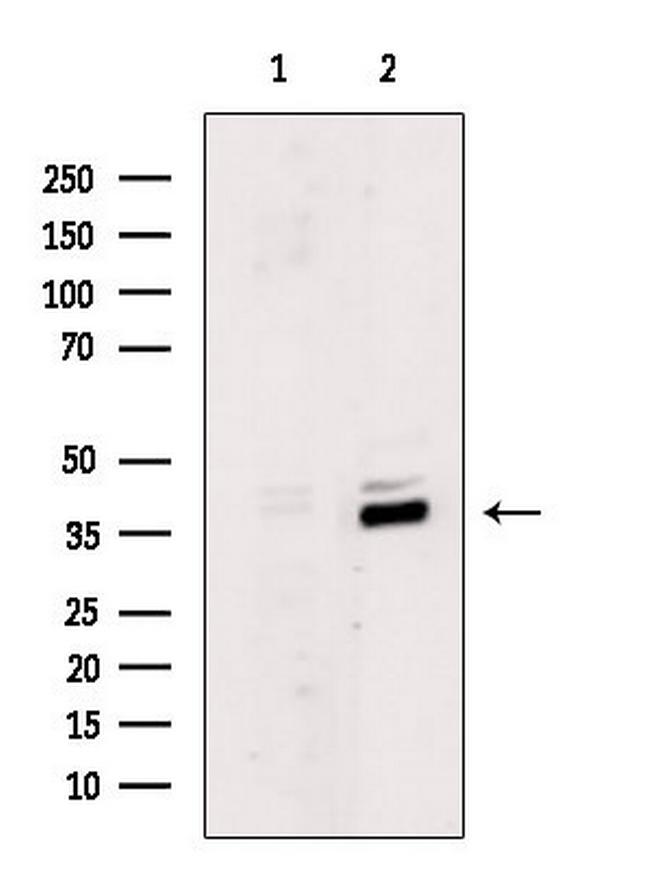 MKX Antibody in Western Blot (WB)