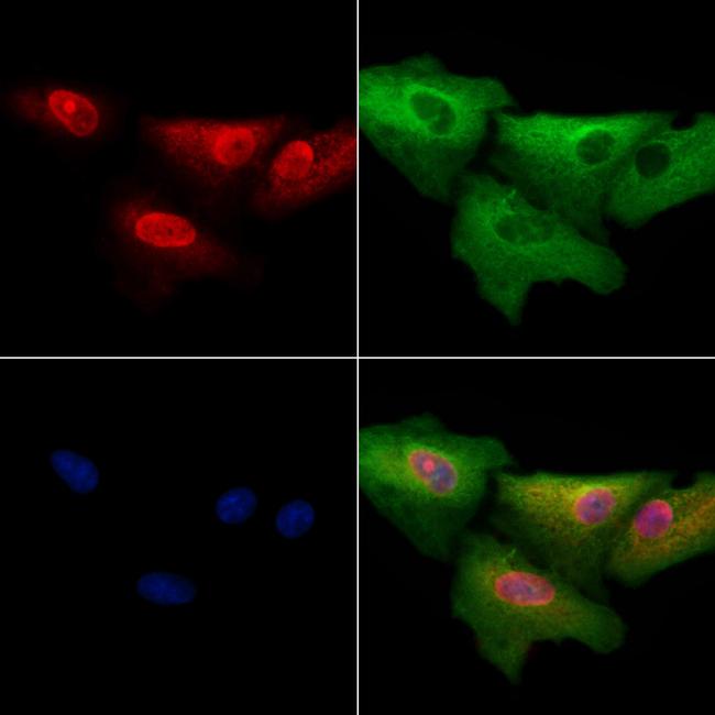 MYOCD Antibody in Immunocytochemistry (ICC/IF)