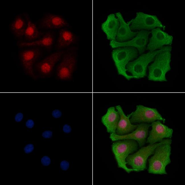 BCL11B Antibody in Immunocytochemistry (ICC/IF)