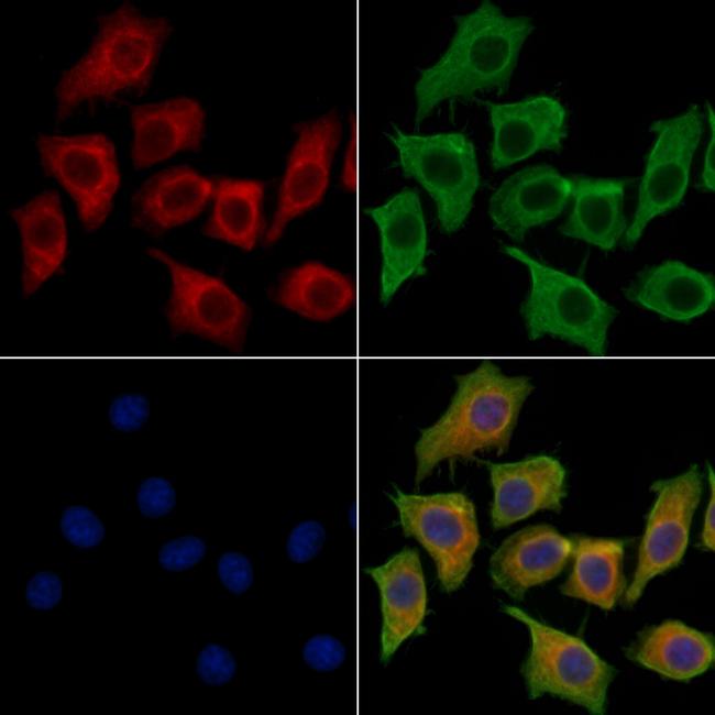 BIN2 Antibody in Immunocytochemistry (ICC/IF)