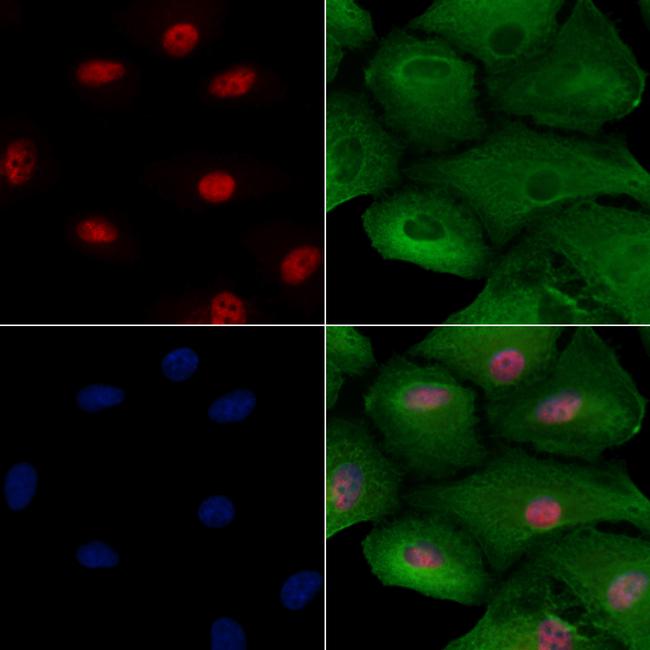 FGF14 Antibody in Immunocytochemistry (ICC/IF)