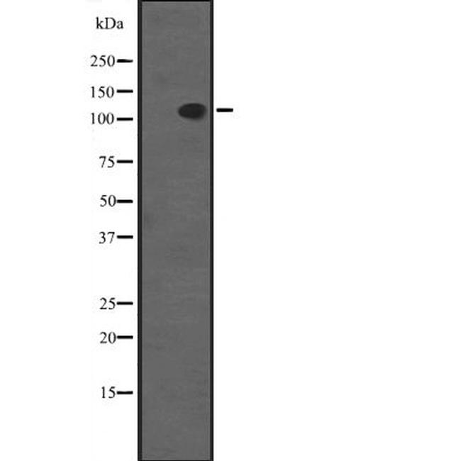 SCP1 Antibody in Western Blot (WB)