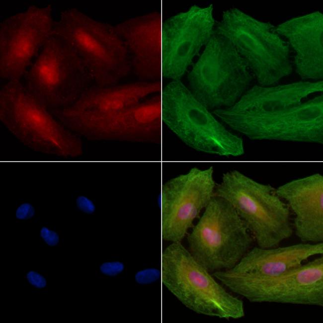 ALKBH4 Antibody in Immunocytochemistry (ICC/IF)