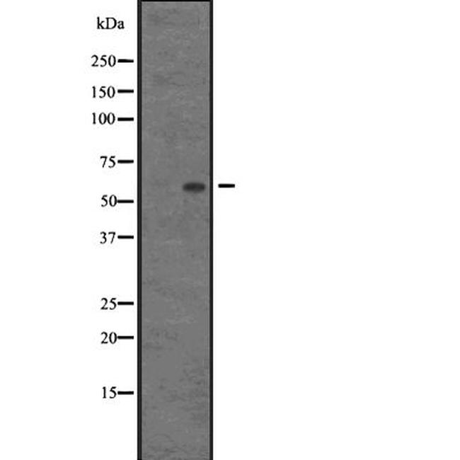 AGFG1 Antibody in Western Blot (WB)