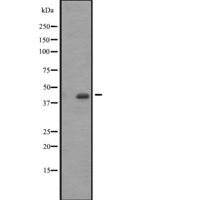 ACTA1/ACTA2/ACTC1 Antibody in Western Blot (WB)