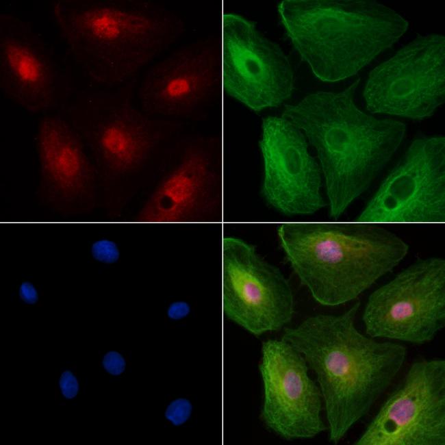 MLCK Antibody in Immunocytochemistry (ICC/IF)