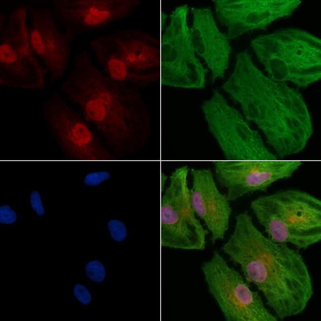 CSNK2A2 Antibody in Immunocytochemistry (ICC/IF)