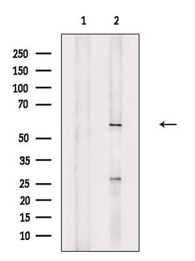 PCTAIRE1 Antibody in Western Blot (WB)