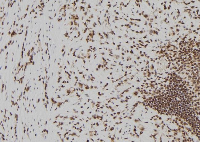 Beclin 2 Antibody in Immunohistochemistry (Paraffin) (IHC (P))