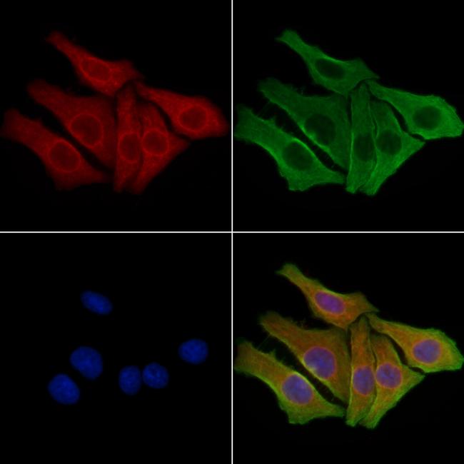 GPR43 Antibody in Immunocytochemistry (ICC/IF)