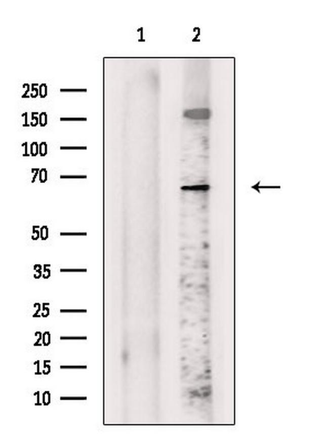 Frizzled 10 Antibody in Western Blot (WB)