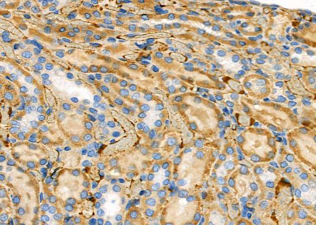 OR1J1 Antibody in Immunohistochemistry (Paraffin) (IHC (P))