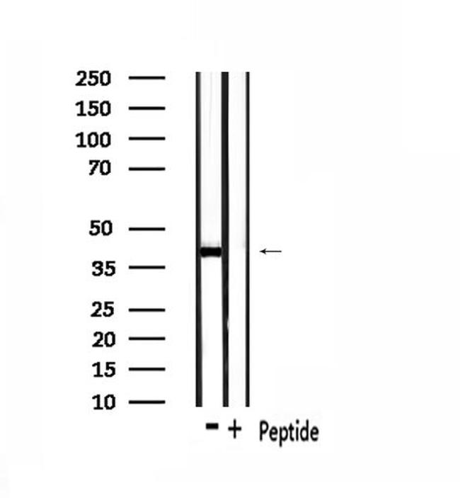 OR1L4/OR1L6 Antibody in Western Blot (WB)