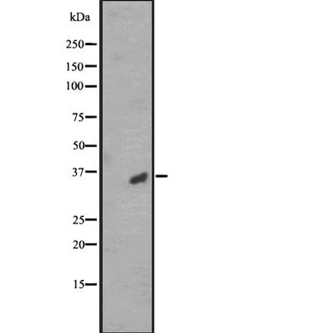 OR2A12 Antibody in Western Blot (WB)