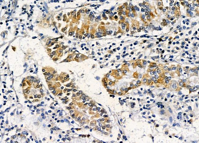 OR2L3/OR2L8 Antibody in Immunohistochemistry (Paraffin) (IHC (P))