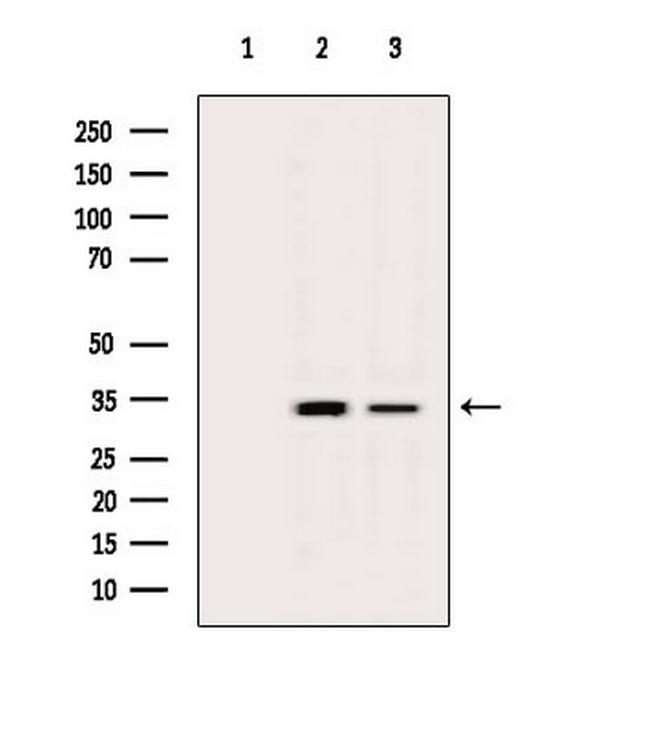 OR2S2 Antibody in Western Blot (WB)