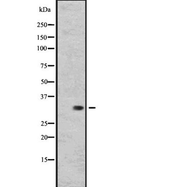 RGR Antibody in Western Blot (WB)