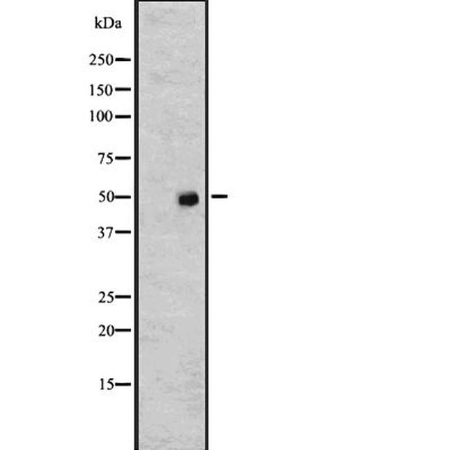 TUBA4A Antibody in Western Blot (WB)