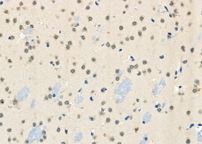 BRD4 Antibody in Immunohistochemistry (Paraffin) (IHC (P))