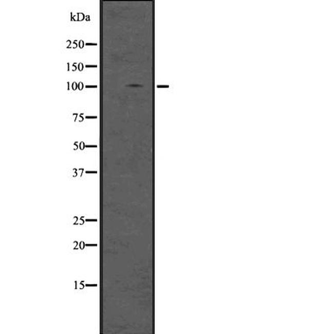 DGCR8 Antibody in Western Blot (WB)