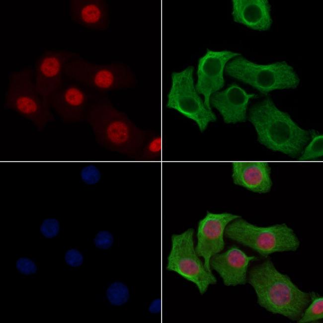 H2AK9ac Antibody in Immunocytochemistry (ICC/IF)