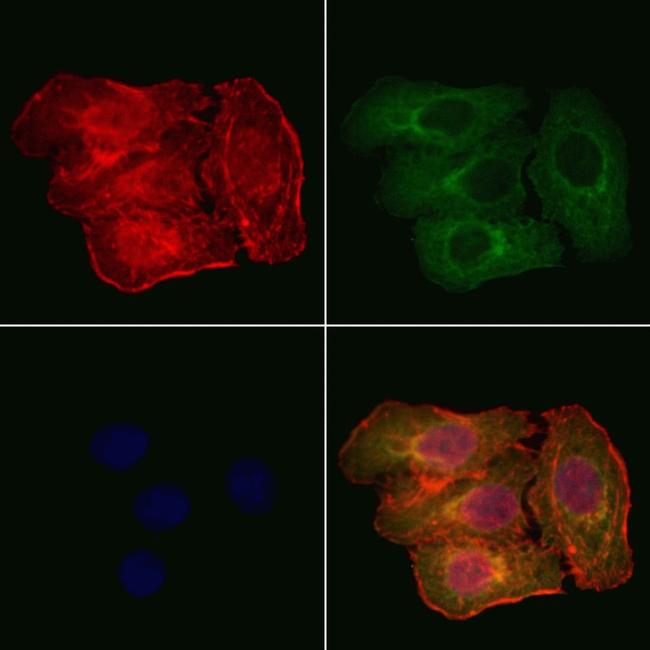 PP1 alpha/beta Antibody in Immunocytochemistry (ICC/IF)