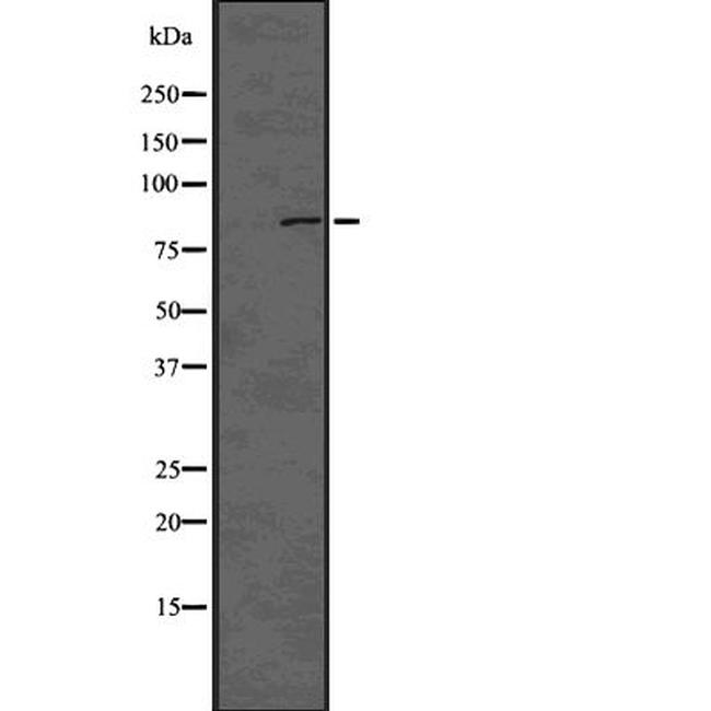 Phospho-DNM1L (Ser616) Antibody in Western Blot (WB)