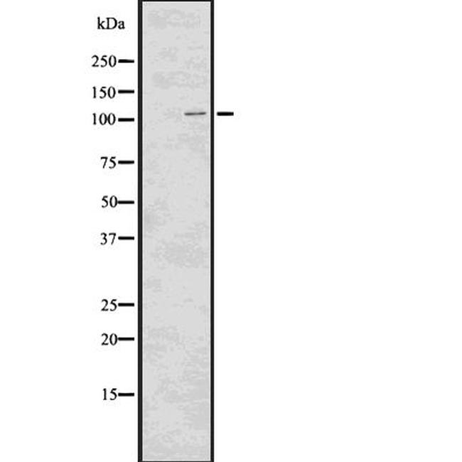 Phospho-EphA2 (Tyr772) Antibody in Western Blot (WB)